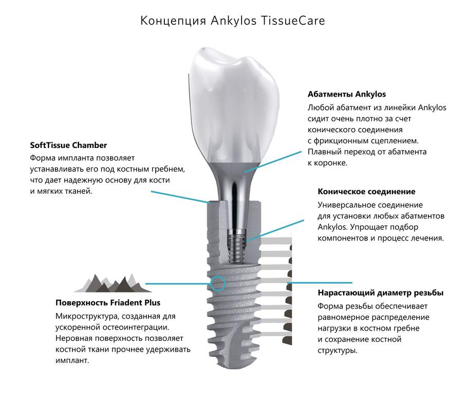 Импланты по концепции TissueCare
