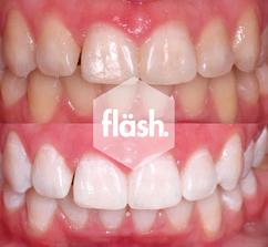 flash результат