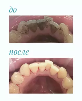 до и после 