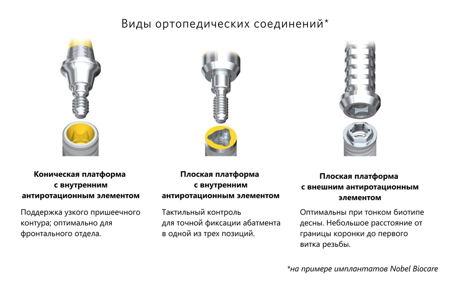 Виды ортопедических соединений на примере Nobel Biocare