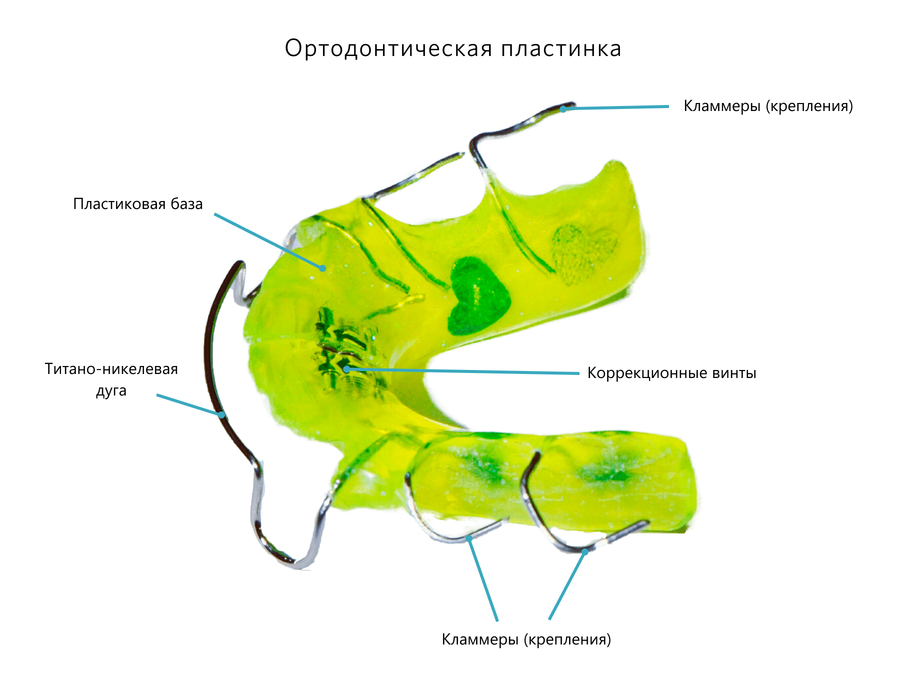 Устройство ортодонтической пластинки