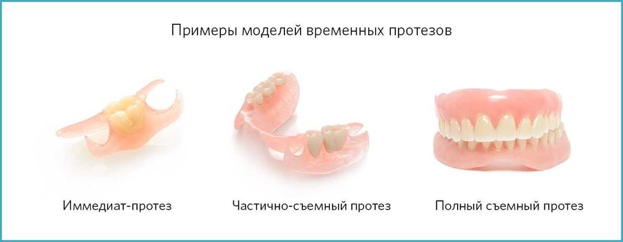 Виды временных протезов