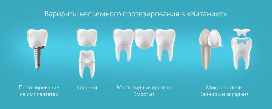 Виды зубных несъемных протезов