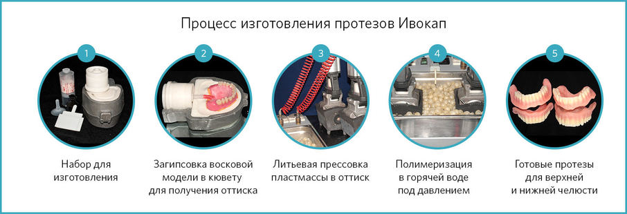 Алгоритм изготовления IVOCAP