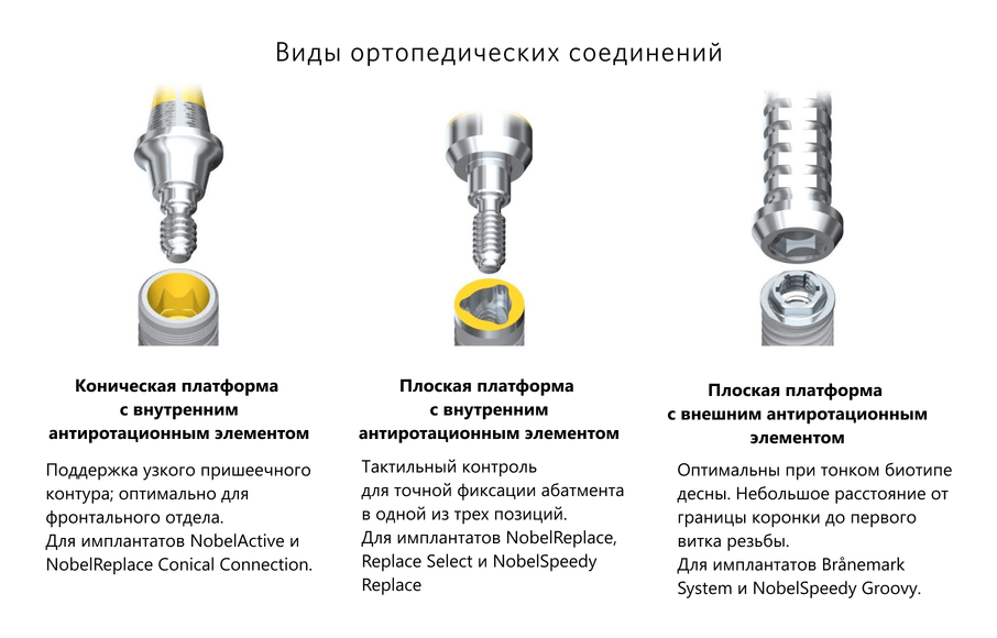 Виды соединений Nobel BioCare