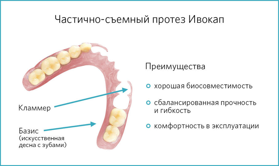 Ивокап протез