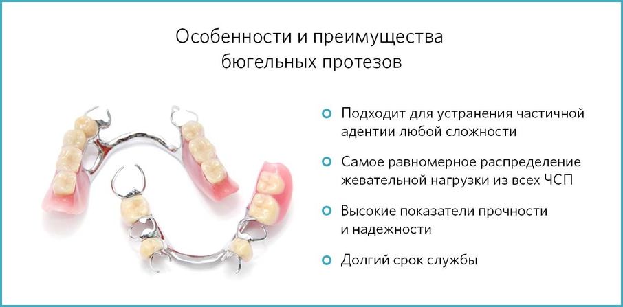 Преимущества бюгельных протезов